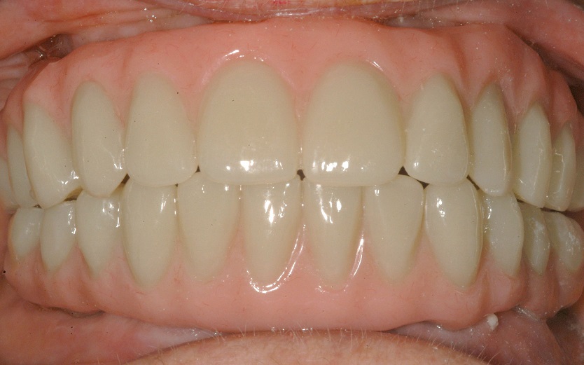 After BarZero LTP Installation